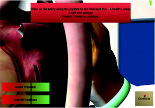 A major artery of a heart inside a lab.